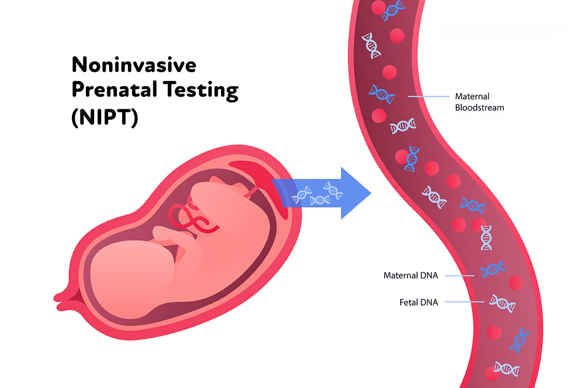 NIPT Non Invasive Prenatal Test