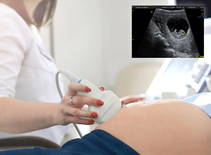 Early Pregnancy Ultrasound Scan